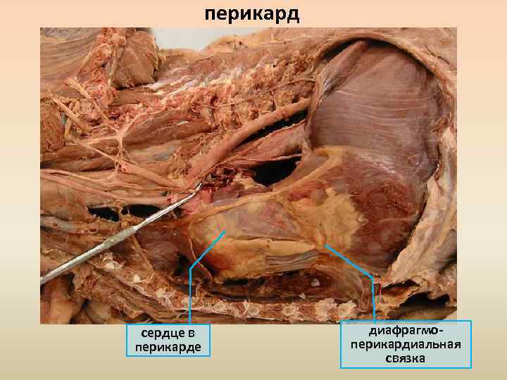 перикард сердце в перикарде диафрагмоперикардиальная связка 