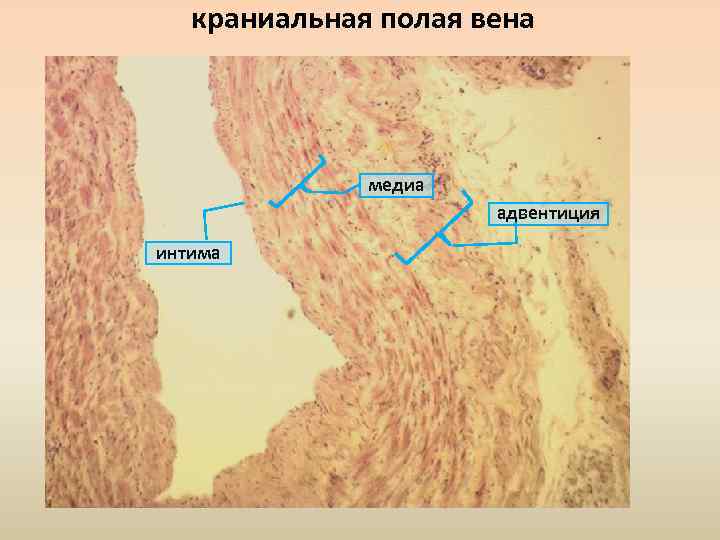 краниальная полая вена медиа адвентиция интима 