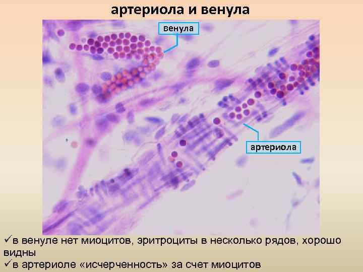 артериола и венула артериола üв венуле нет миоцитов, эритроциты в несколько рядов, хорошо видны