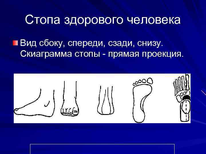 Стопа здорового человека Вид сбоку, спереди, сзади, снизу. Скиаграмма стопы - прямая проекция. 