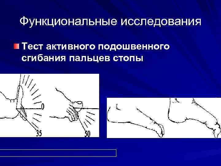 Функциональные исследования Тест активного подошвенного сгибания пальцев стопы 