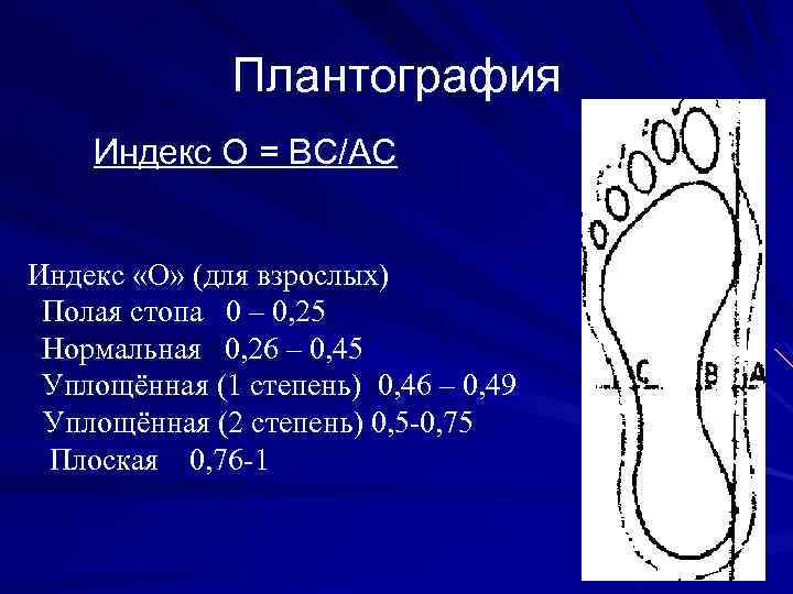 Плантография Индекс О = ВС/АС Индекс «О» (для взрослых) Полая стопа 0 – 0,