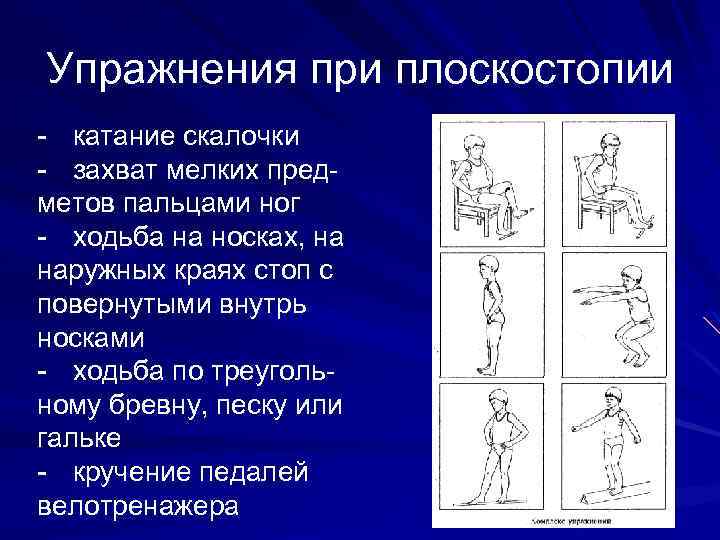 Упражнения при плоскостопии - катание скалочки - захват мелких предметов пальцами ног - ходьба