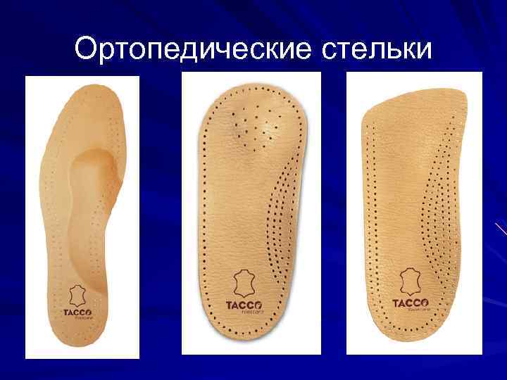 Ортопедические стельки 