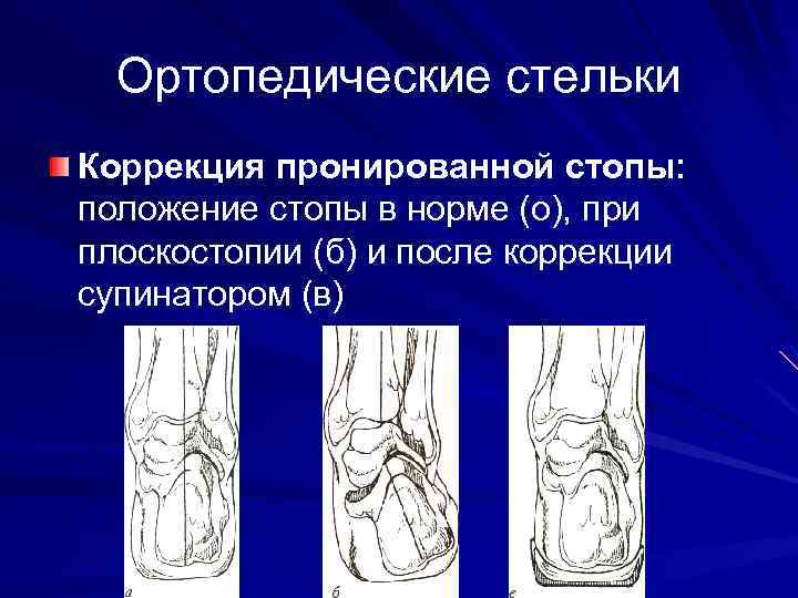 Функции стопы. Пронированное положение. Отводящие и пронирующие стопу. Положение стопы презентация.