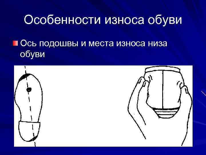 Особенности износа обуви Ось подошвы и места износа низа обуви 
