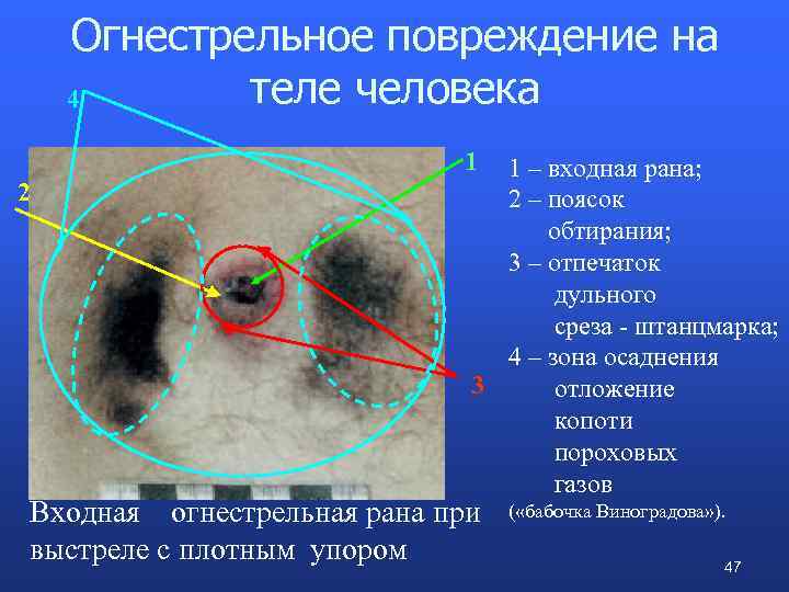 Огнестрельные повреждения презентация