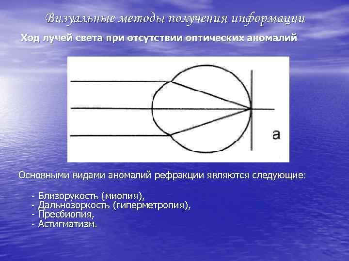 Визуальные методы получения информации Ход лучей света при отсутствии оптических аномалий Основными видами аномалий