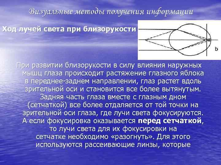 Визуальные методы получения информации Ход лучей света при близорукости При развитии близорукости в силу