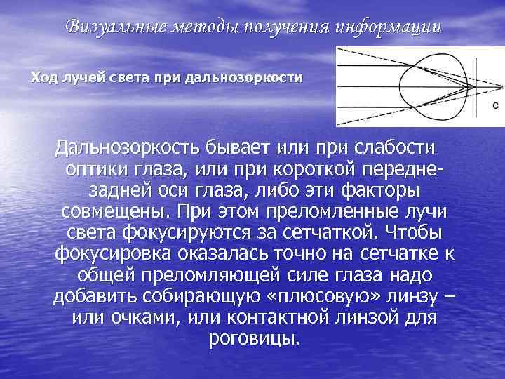 Визуальные методы получения информации Ход лучей света при дальнозоркости Дальнозоркость бывает или при слабости