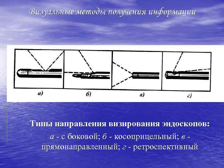 Визуальные методы получения информации Типы направления визирования эндоскопов: а - с боковой; б косоприцельный;