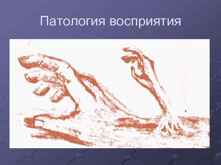 Патология восприятия 