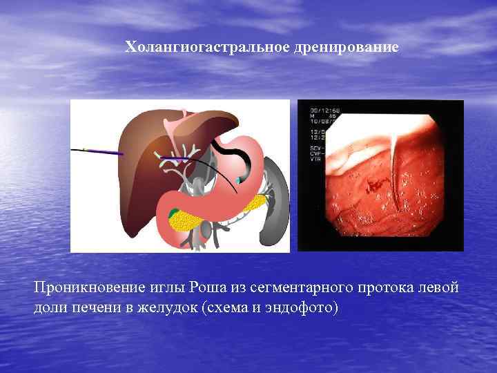 Схема анального проникновения