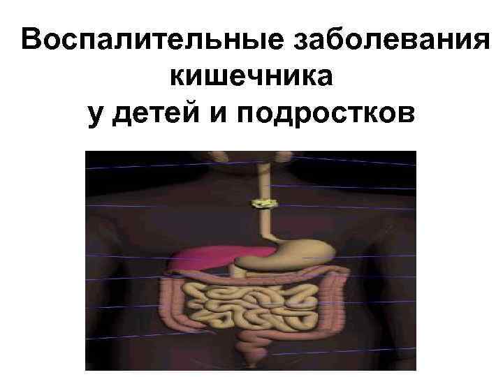 Воспалительные заболевания кишечника у детей и подростков 