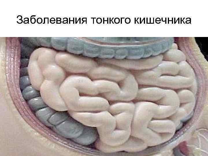 Заболевания тонкого кишечника 