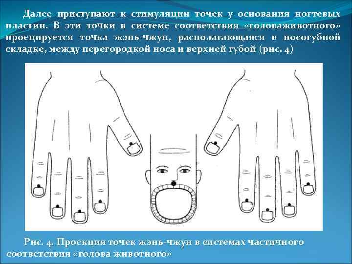 Далее приступают к стимуляции точек у основания ногтевых пластин. В эти точки в системе