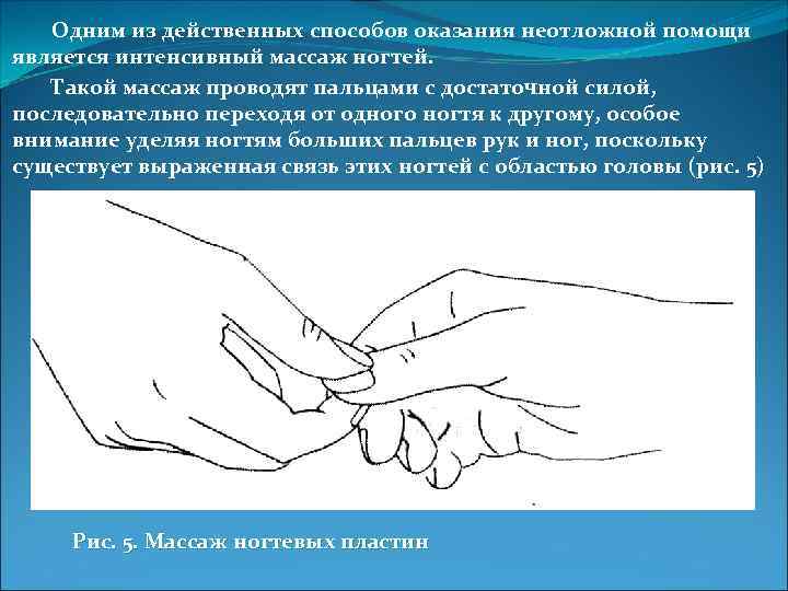 Одним из действенных способов оказания неотложной помощи является интенсивный массаж ногтей. Такой массаж проводят