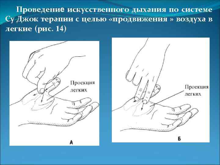 Проведение искусственного дыхания по системе Су Джок терапии с целью «продвижения » воздуха в