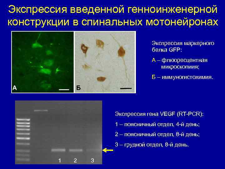 Экспрессия введенной генноинженерной конструкции в спинальных мотонейронах Экспрессия маркерного белка GFP: A – флюоресцентная