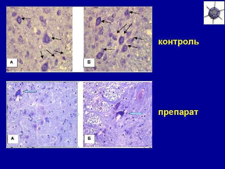 контроль препарат 