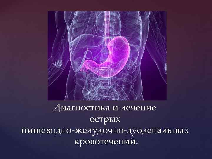 Диагностика и лечение острых пищеводно-желудочно-дуоденальных кровотечений. 