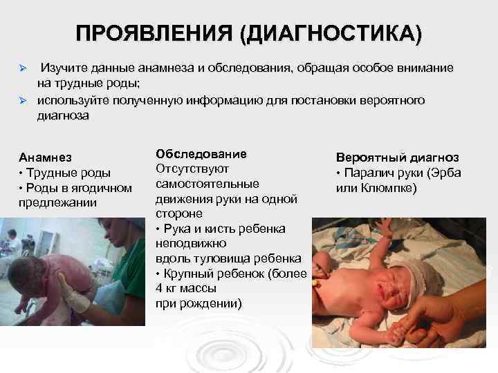 ПРОЯВЛЕНИЯ (ДИАГНОСТИКА) Изучите данные анамнеза и обследования, обращая особое внимание на трудные роды; Ø