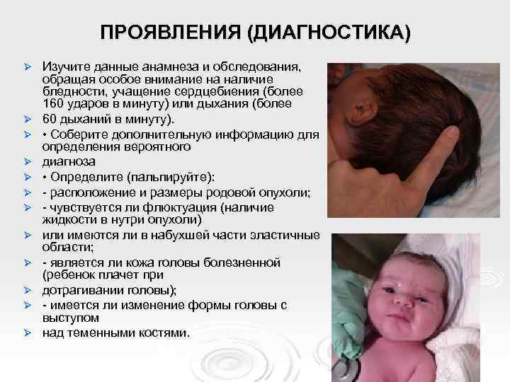 ПРОЯВЛЕНИЯ (ДИАГНОСТИКА) Ø Ø Ø Изучите данные анамнеза и обследования, обращая особое внимание на