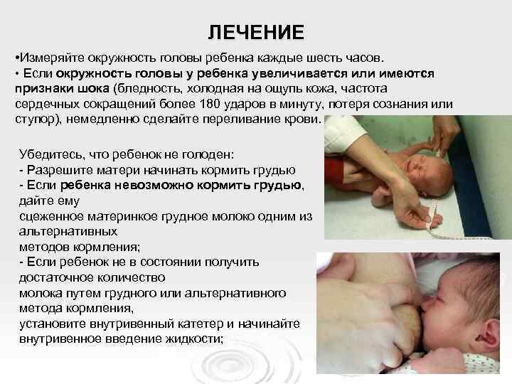 ЛЕЧЕНИЕ • Измеряйте окружность головы ребенка каждые шесть часов. • Если окружность головы у