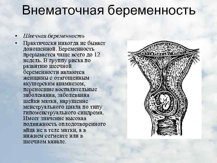 Кровотечение во время беременности презентация