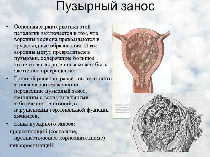 Морфологическая картина нарушенной маточной беременности что это значит у женщин