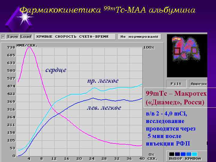 Фармакокинетика 99 m. Тс-МАА альбумина сердце пр. легкое лев. легкое 99 m. Тс –