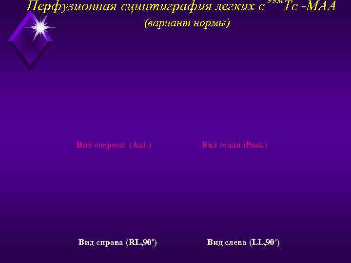 Перфузионная сцинтиграфия легких с 99 м Тс -МАА (вариант нормы) Вид спереди (Ant. )