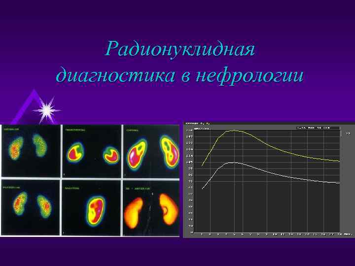 Радионуклидная диагностика в нефрологии 