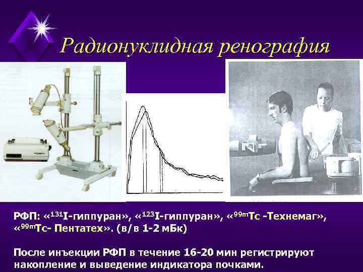 Радионуклидная ренография РФП: « 131 I-гиппуран» , « 123 I-гиппуран» , « 99 m.