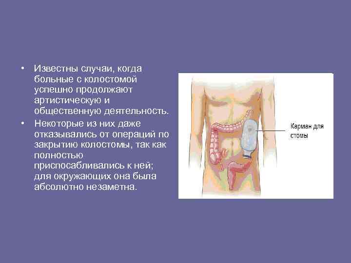  • Известны случаи, когда больные с колостомой успешно продолжают артистическую и общественную деятельность.