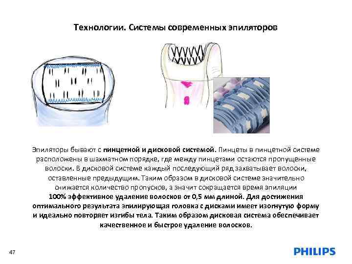 Технологии. Системы современных эпиляторов Эпиляторы бывают с пинцетной и дисковой системой. Пинцеты в пинцетной