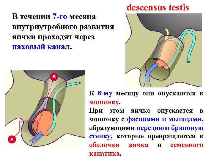 В течении 7 -го месяца внутриутробного развития яички проходят через паховый канал. descensus testis