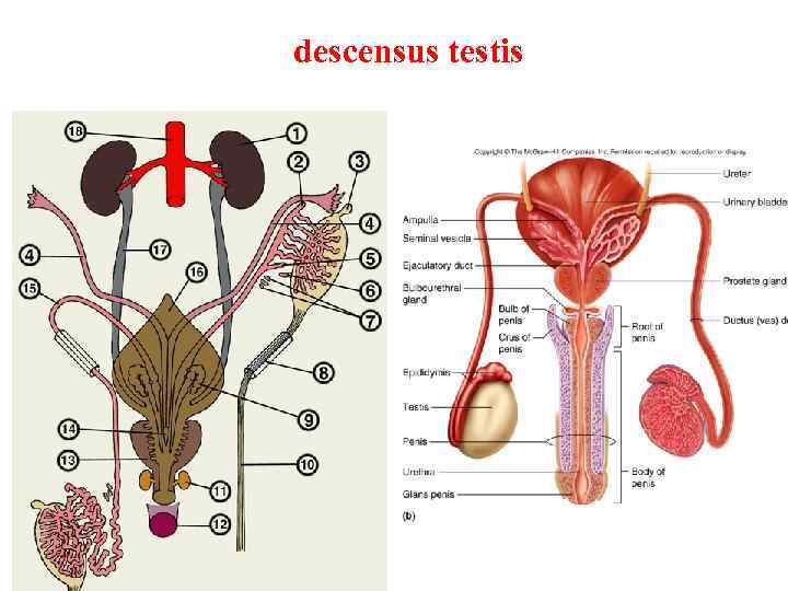 descensus testis 