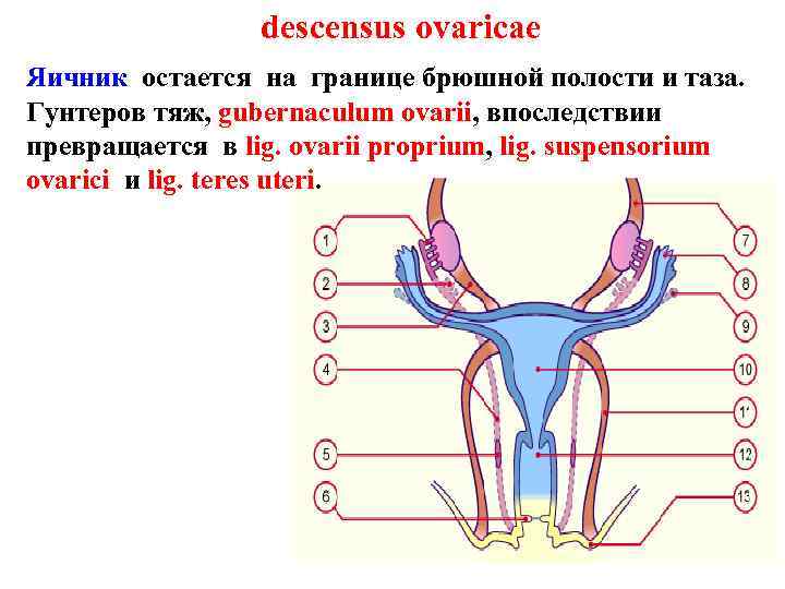 descensus ovaricae Яичник остается на границе брюшной полости и таза. Гунтеров тяж, gubernaculum ovarii,