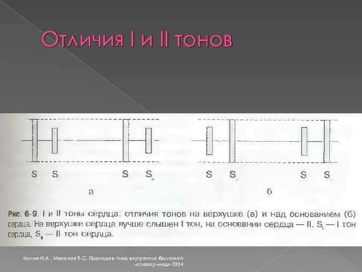 Отличия I и II тонов Мухин Н. А. , Моисеев В. С. Пропедев- тика