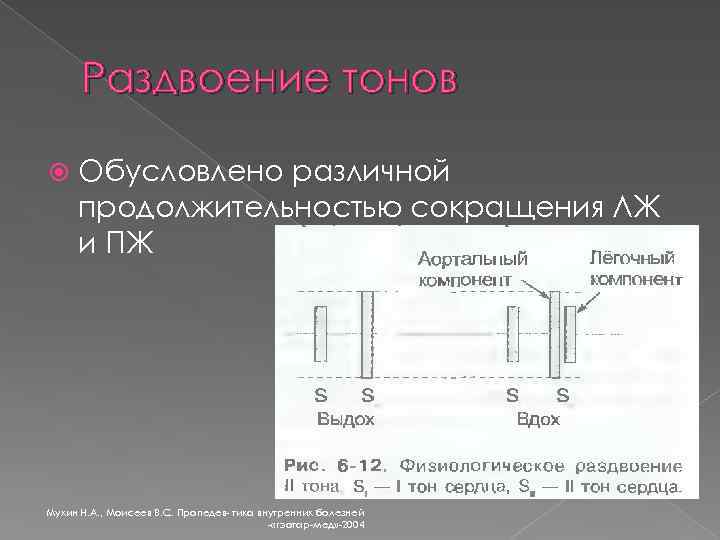 Раздвоение тонов Обусловлено различной продолжительностью сокращения ЛЖ и ПЖ Мухин Н. А. , Моисеев