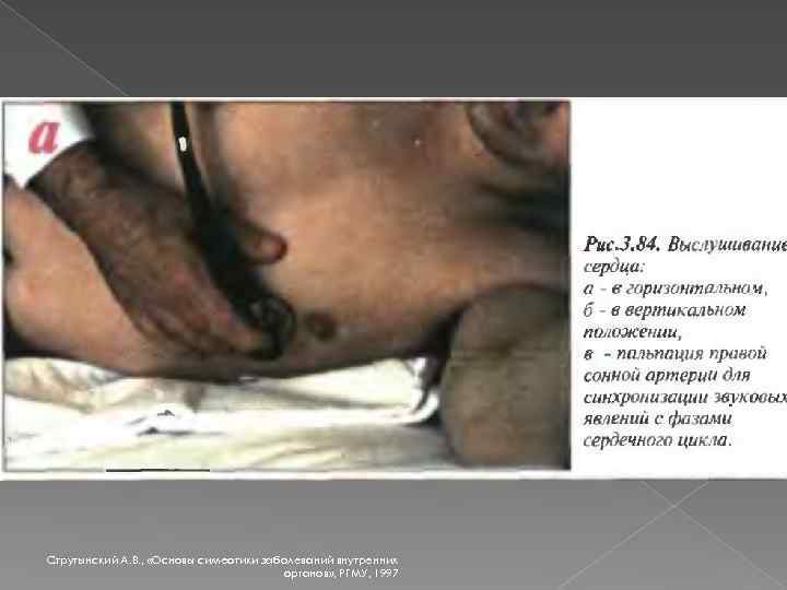 Струтынский А. В. , «Основы симеотики заболеваний внутренних органов» , РГМУ, 1997 