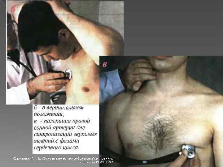 Струтынский А. В. , «Основы симеотики заболеваний внутренних органов» , РГМУ, 1997 