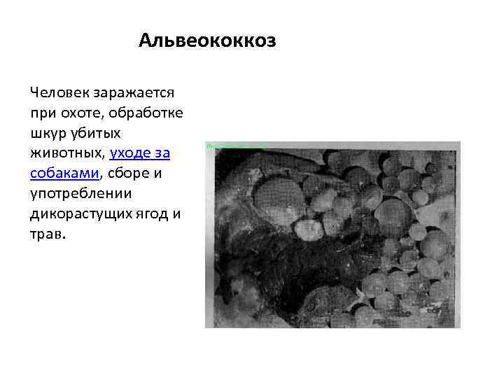 Альвеококкоз Человек заражается при охоте, обработке шкур убитых животных, уходе за собаками, сборе и