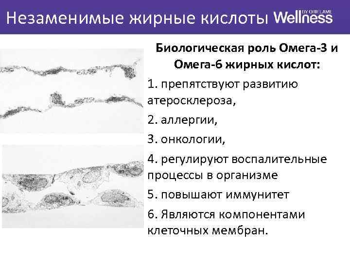 Незаменимые жирные кислоты Биологическая роль Омега-3 и Омега-6 жирных кислот: 1. препятствуют развитию атеросклероза,