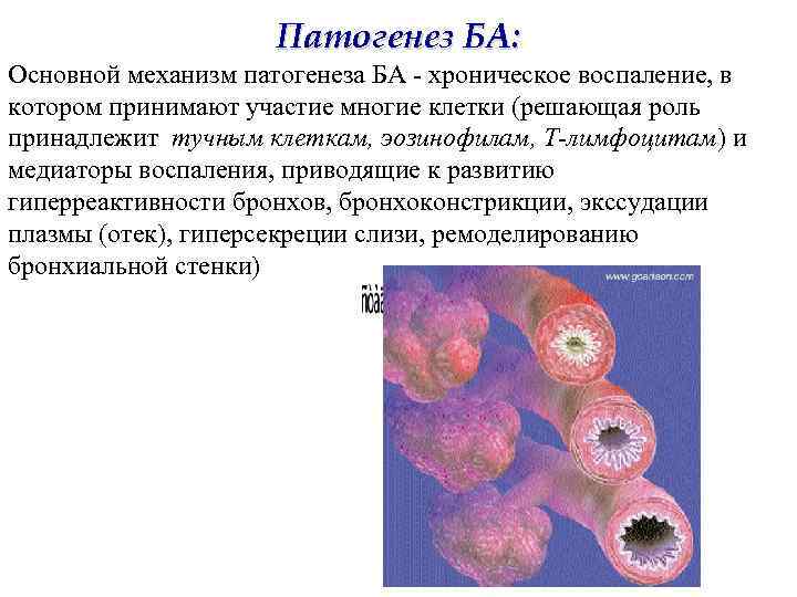 Патогенез БА: Основной механизм патогенеза БА - хроническое воспаление, в котором принимают участие многие