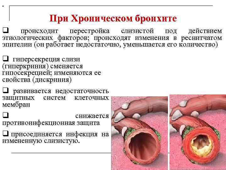 . При Хроническом бронхите q происходит перестройка слизистой под действием этиологических факторов; происходят изменения