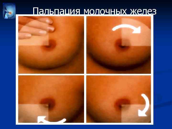 Пальпация молочных желез 