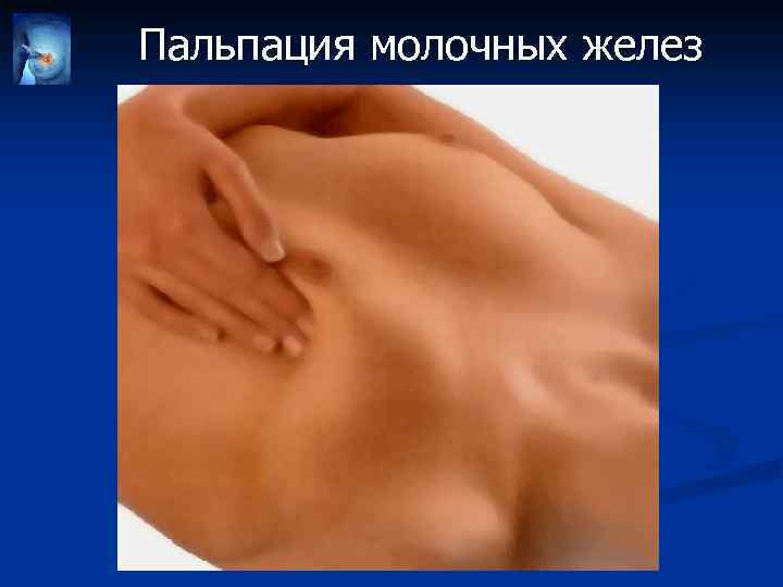 Пальпация молочных желез 