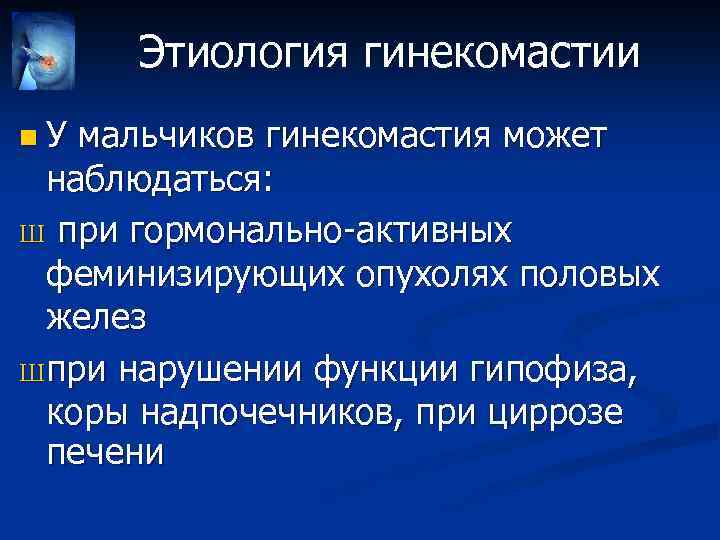 Этиология гинекомастии n У мальчиков гинекомастия может наблюдаться: Ш при гормонально-активных феминизирующих опухолях половых